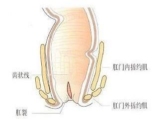 成人肛门治疗视频教程,成人护理必备技能解析